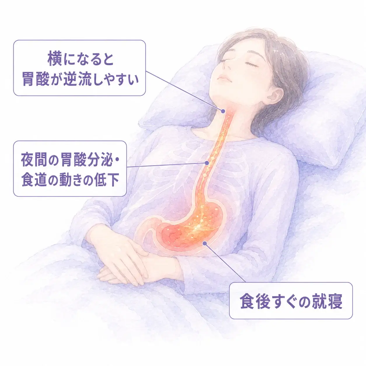 逆流性食道炎で夜中に目が覚める理由（横になると胃酸が逆流する仕組み）の図解イメージ